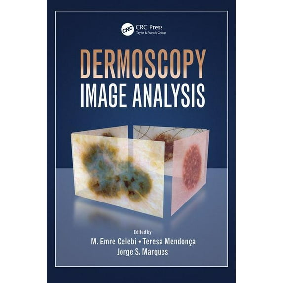 Digital Imaging and Computer Vision Dermoscopy Image Analysis, Book 10, (Hardcover)