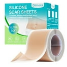 Silicone Scar Sheets – Silicone Scar Tape for C-Section, Tummy Tuck & Keloid Scars (1.6" x 59" Roll, 1.5M) – Effective Scar Removal & Keloid Bump Treatment