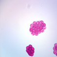 thumbnail image 1 of Dipylidium Caninum Eggs Slide, W.M., 1 of 1