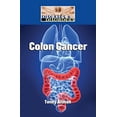 thumbnail image 1 of Pre-Owned Colon Cancer (Library Binding) 1420507923 9781420507928, 1 of 1