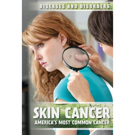 Diseases & Disorders Skin Cancer: America's Most Common Cancer, (Hardcover)