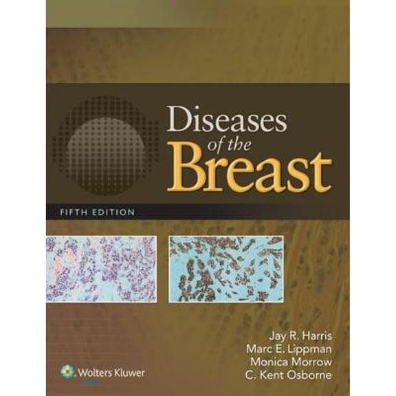 Pre-Owned Diseases of the Breast 5e