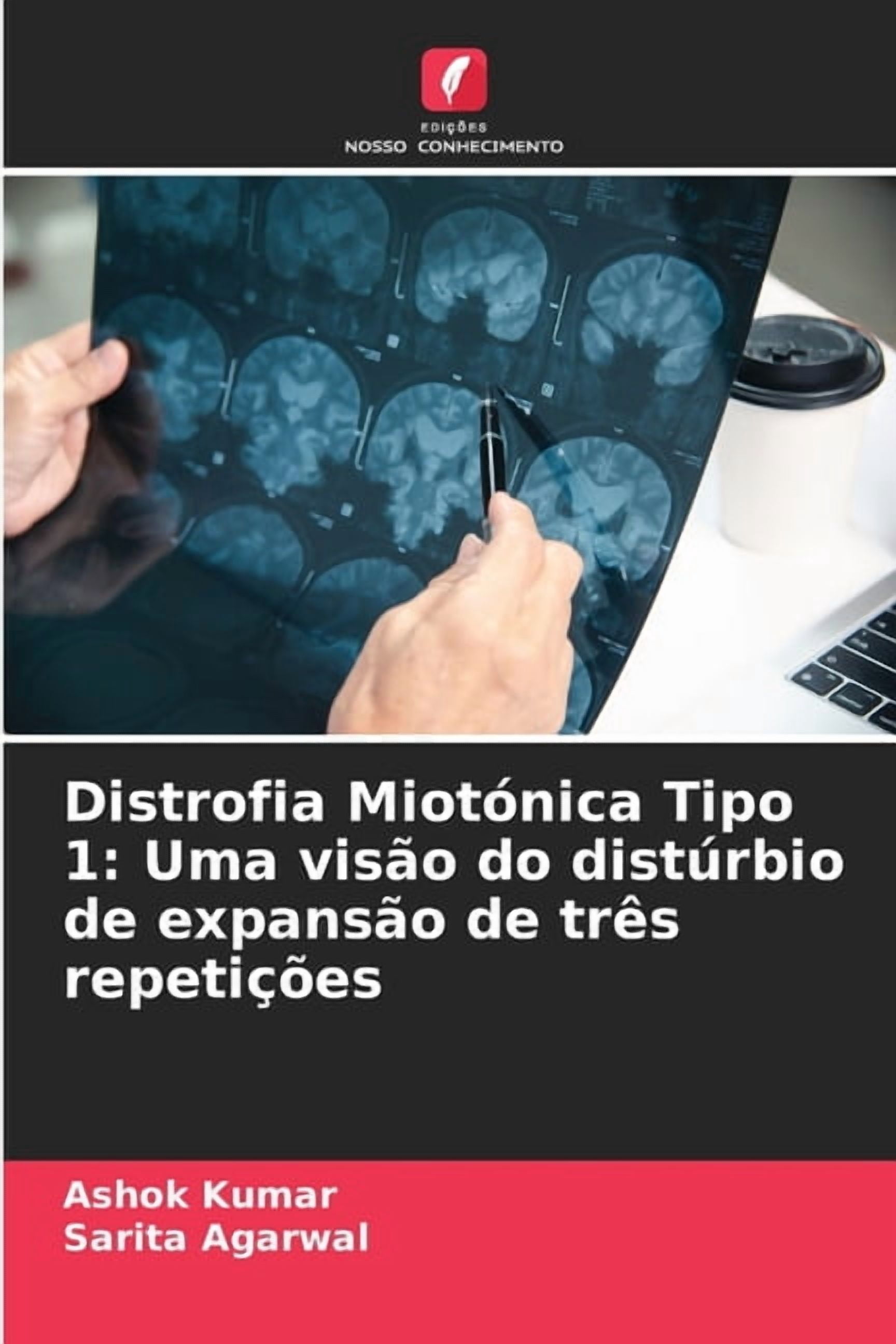 Distrofia Miotónica Tipo 1: Uma visão do distúrbio de expansão de três ...