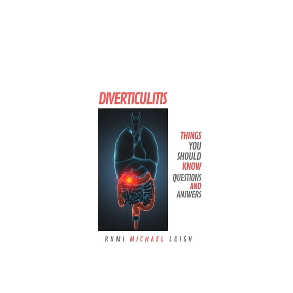 Diverticulitis: Things You Should Know (Questions and Answers), (Paperback)