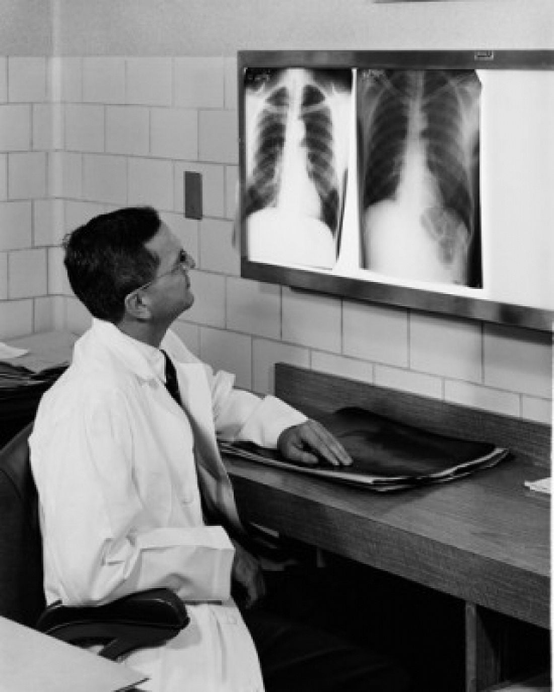Doctor analyzing X-ray images of lungs Canvas Art - (24 x 36)