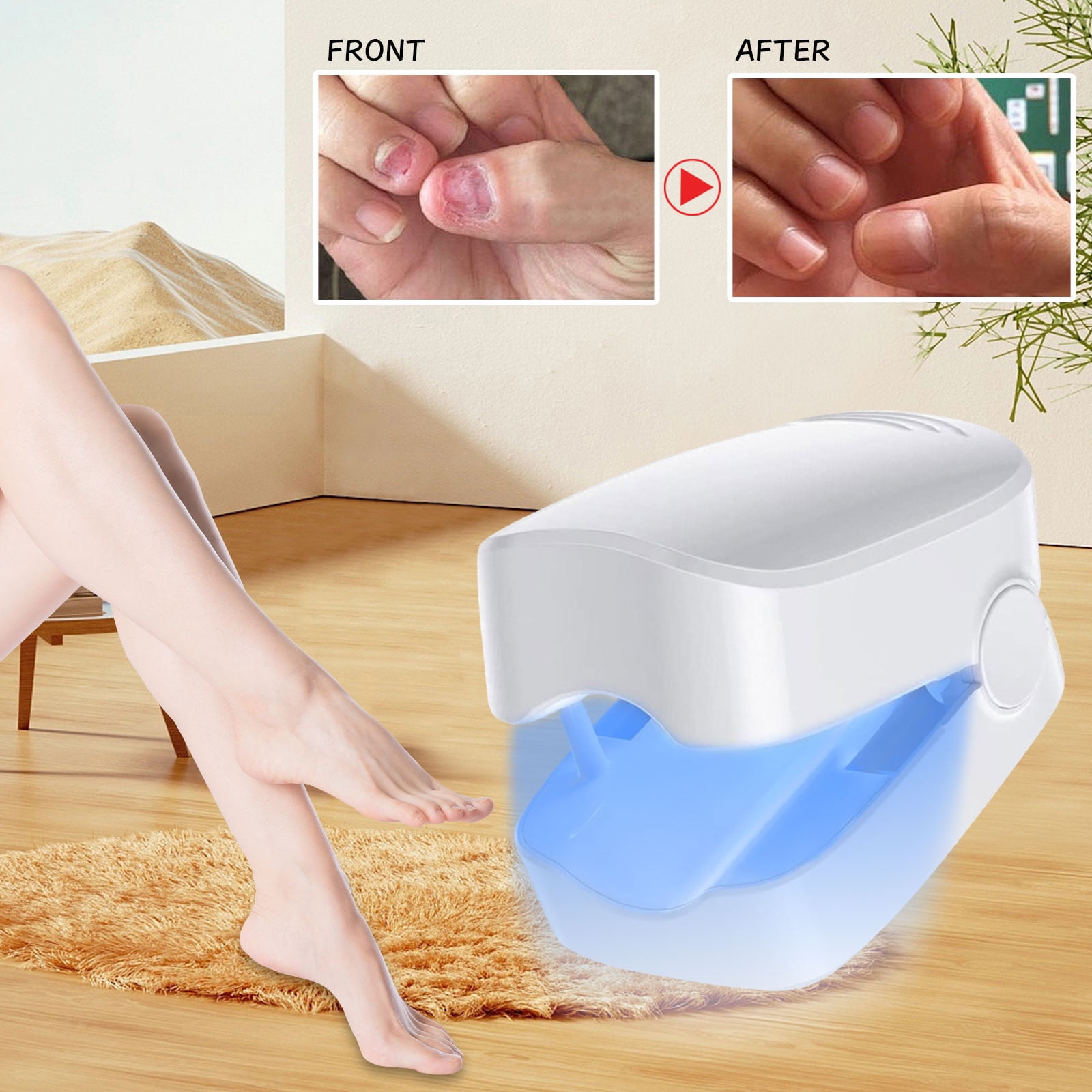 Dont Miss! Gomind Fivfivgo Light Therapy Device for Nail Fungus, Nail  Fungus Treatment Device, Portable Cold Laser Therapy, Nail Cleaning and  Care Device - Walmart.com