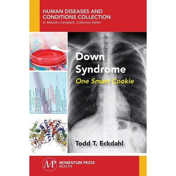 Down Syndrome: One Smart Cookie, (Paperback)