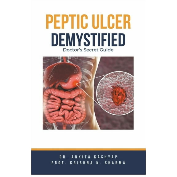 Dr Ankita Kashyap: Peptic Ulcer Demystified: Doctor's Secret Guide (Paperback)