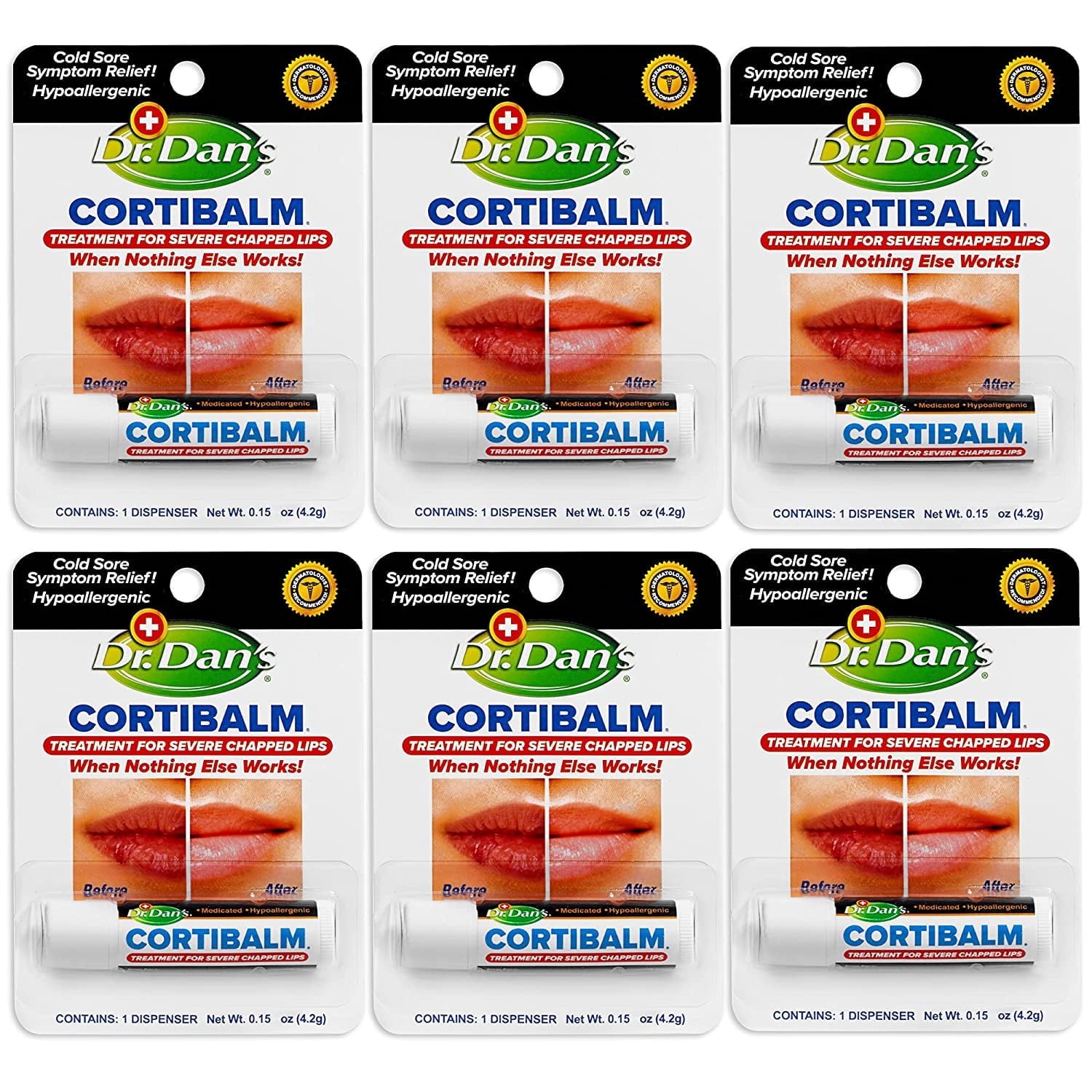 Dr. Dan's CortiBalm Medicated Lip Balm with 1% Hydrocortisone for Dry, Chapped Lips, 0.25 oz, 6 Count