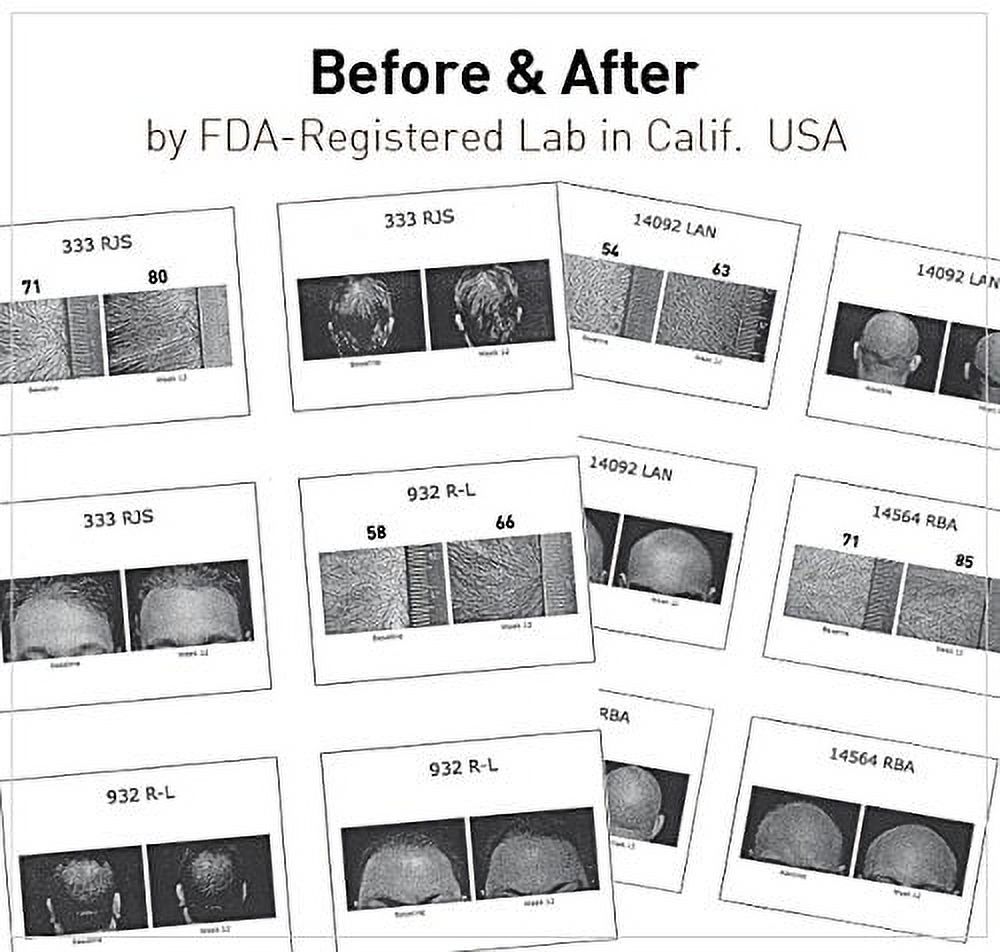 Dr ROSS' BIOGEM Clinically Proven Hair Loss Hair Care Set Shampoo