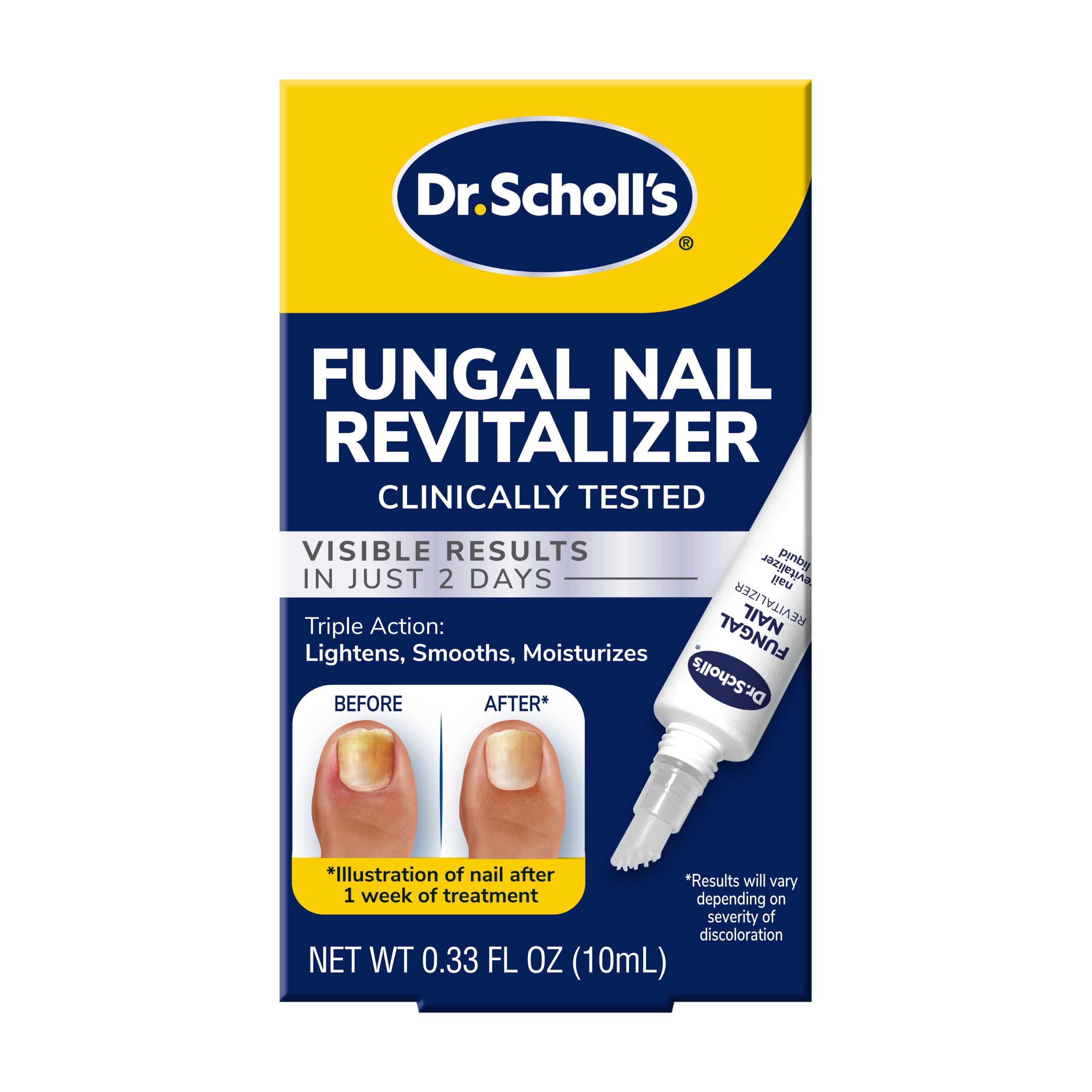 Scholl Fungal Nail Kit 2.5ml, 2.5ml : Bath & Beauty fast delivery by App or  Online