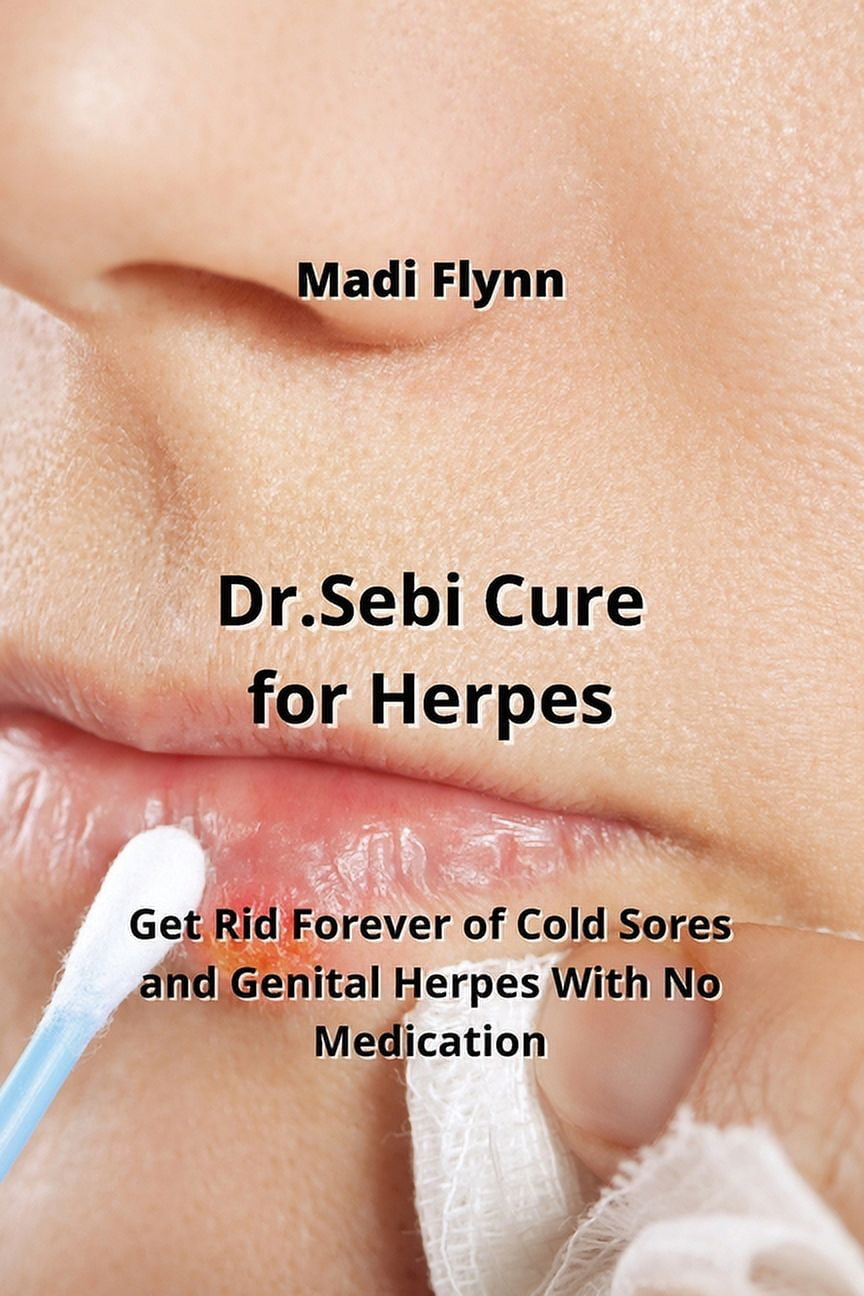 dr-sebi-cure-for-herpes-get-rid-forever-of-cold-sores-and-genital