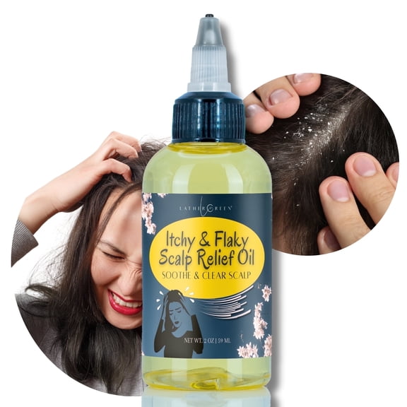 Dry, Itchy & Flaky Scalp Relief Oil Natural Leave-In Treatment for Dry, 2 oz - by LatherGreen