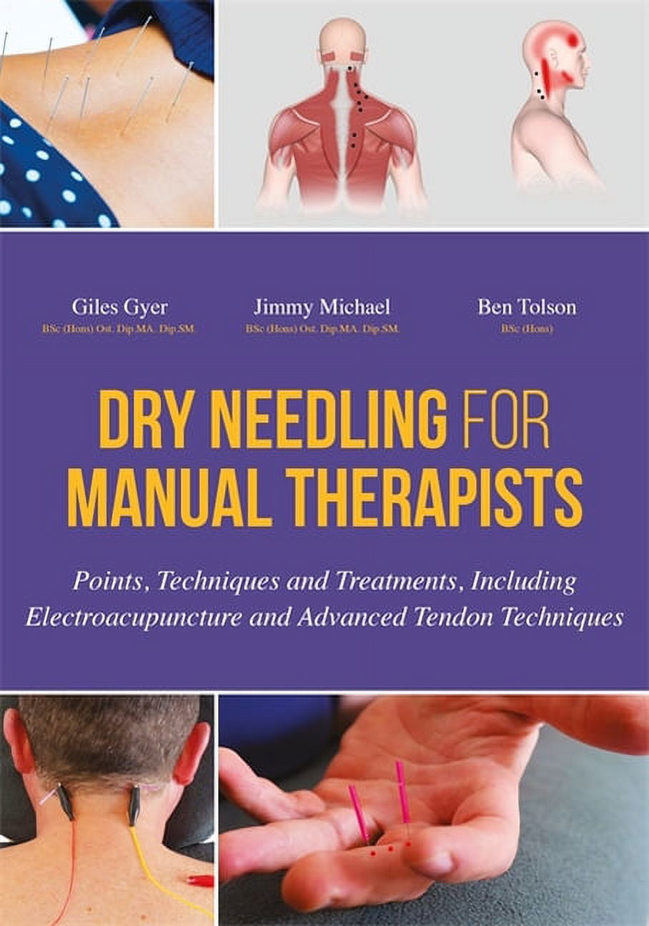 Dry Needling for Manual Therapists: Points, Techniques and Treatments, Including Electroacupuncture and Advanced Tendon , (Hardcover)