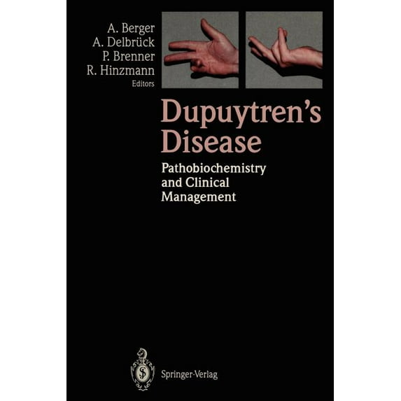Dupuytren's Disease: Pathobiochemistry and Clinical Management, (Paperback)
