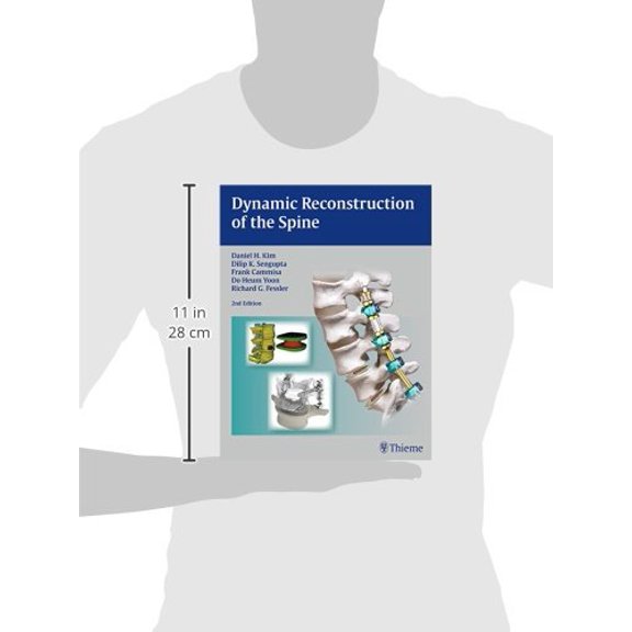 Pre-Owned Dynamic Reconstruction of the Spine [Hardcover] Kim, Daniel H.; Cammisa, Frank P; Fessler, Richard Glenn; Sengupta, Dilip K and Yoon, Do Heum