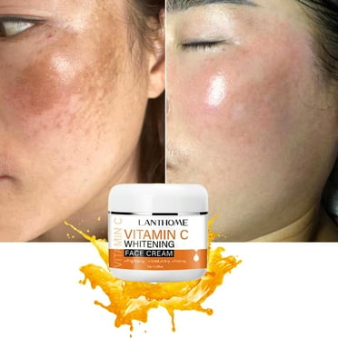 EARKITY Vitamin C Cream For Face, Vitamin C Moisturizing Cream, Day & Night Cream Facial Moisturizer, Anti-aging Hydration Skin Firming & Brightening Cream for Dark Spots, Wrinkles
