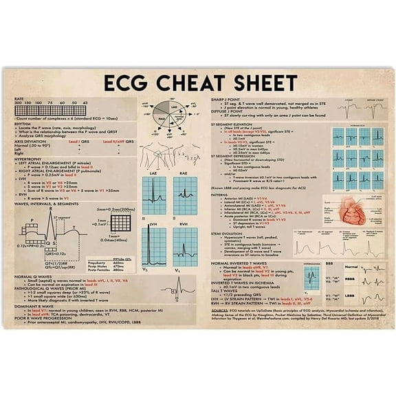 ECG Cheat Sheet Metal Sign Vintage Office Decor ECG Knowledge Tin Poster Club Hospital Home Wall Decoration Plaque 8x12 inches