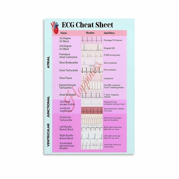 ECG Cheat Sheet Quick Reference Guide Poster Medical Office Wall Art Canvas Painting Posters And Prints Wall Art for Living Room Bedroom Decor
