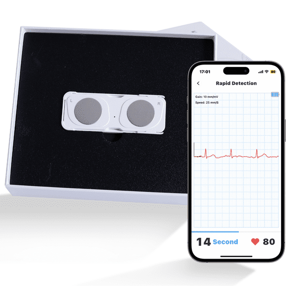 ECG/EKG Heart Monitor | 30-Second Smartphone EKG Display | No Subscription Required | FSA/HSA Eligible