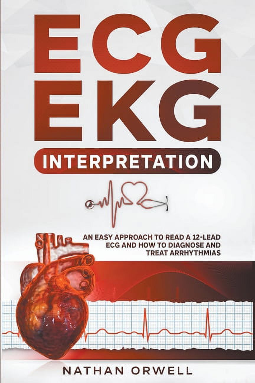 ECG/EKG Interpretation: An Easy Approach to Read a 12-Lead ECG and How ...