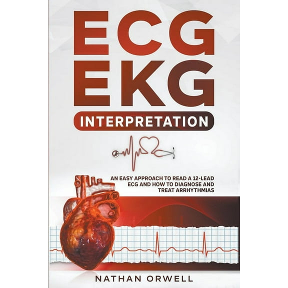 ECG/EKG Interpretation: An Easy Approach to Read a 12-Lead ECG and How to Diagnose and Treat Arrhythmias, (Paperback)