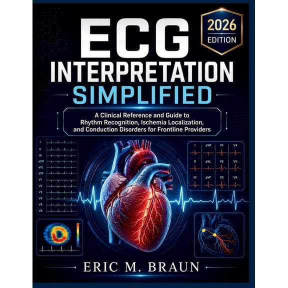ECG Interpretation Simplified: A Clinical Reference and Guide to Rhythm Recognition, Ischemia Localization, and Conducti, (Paperback)
