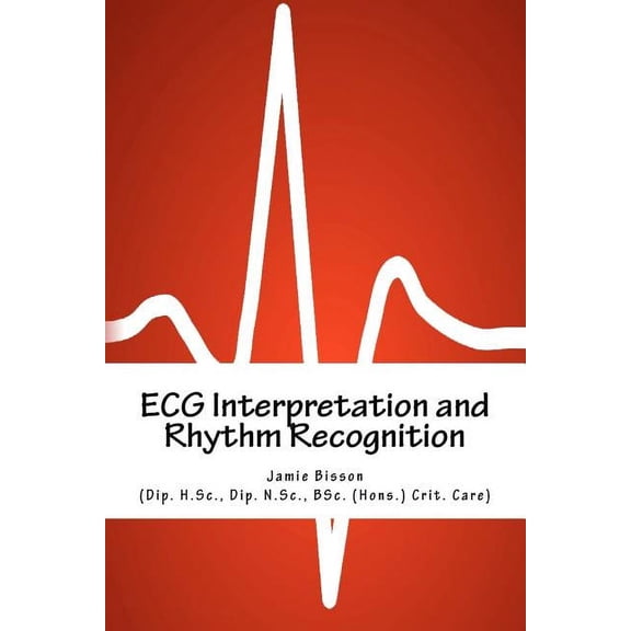 ECG Interpretation and Rhythm Recognition (Paperback)