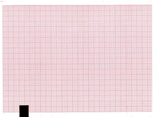 ECG Paper 10MM X 150MM X 200 Sheets (Works with HUNTLEIGH BD4000) (5)