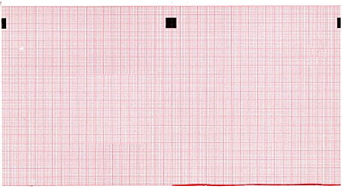 ECG Paper 112MM X 100MM X 300 Sheets (Works for CARDIOLINE Delta 3 Plus, Delta 6) (5)