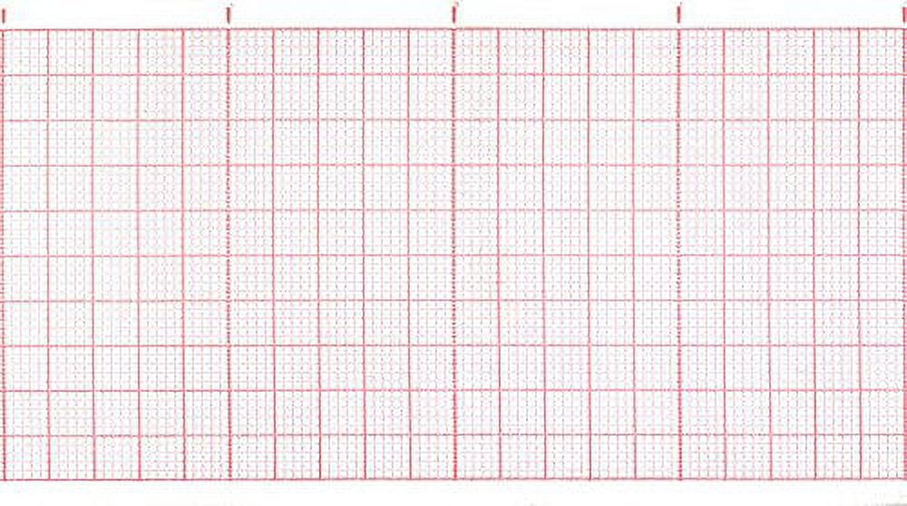 ECG Paper 57MM X 30M (Works for CONTEC 80A, MACQUAIRE CT200) (10)