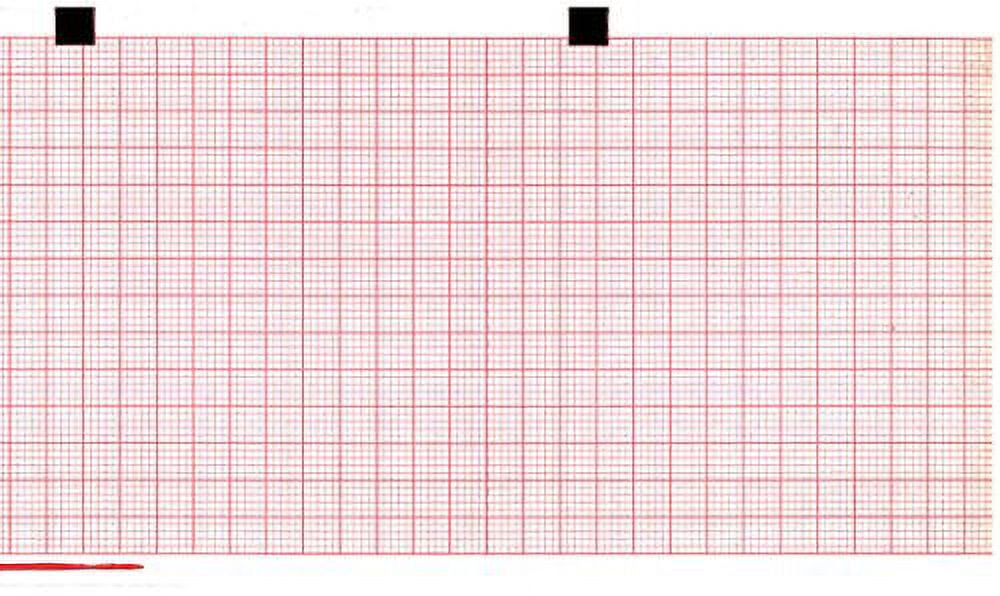 ECG Paper 80MM X 70MM X 300Sheets (Works for Schiller AT101, 2157026, 9690029300, Argus LCM, DEFIGARD, SECA CT 8000i, P8000/8000I) (10)
