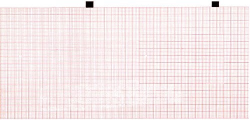 ECG Paper 90MM X 90MM X 360Sheets (Works for HELLIGE/Marquette, MAC 500, 22616702) (5)