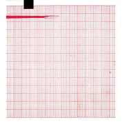 ECG Paper 90MMx70MMx400Sheets Works for ESAOTE P80/SECA, CT300/M, 9690029000, FUTUREMED EZ3, Medical Systems M90 181-M90-J 5