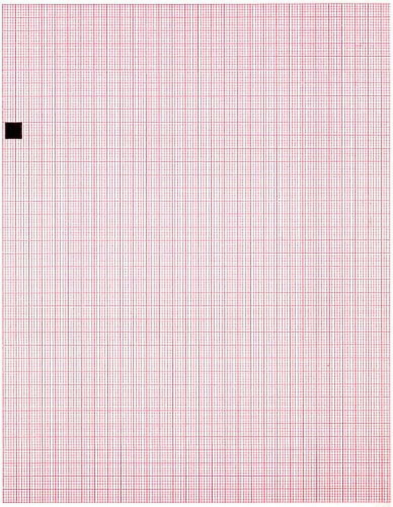 ECG Paper Z-FOLD 209MM X 150MM X 150 Sheets (Works with CARDIETTE AR2100, RED GRIDSTART 200, 66010027 (10)