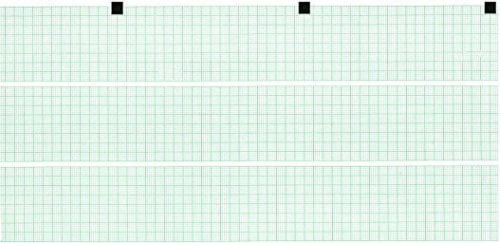 ECG Paper for CARDIOLINE E3 (134MMX30M) (5)