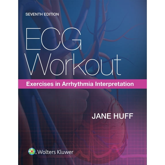ECG Workout : Exercises in Arrhythmia Interpretation