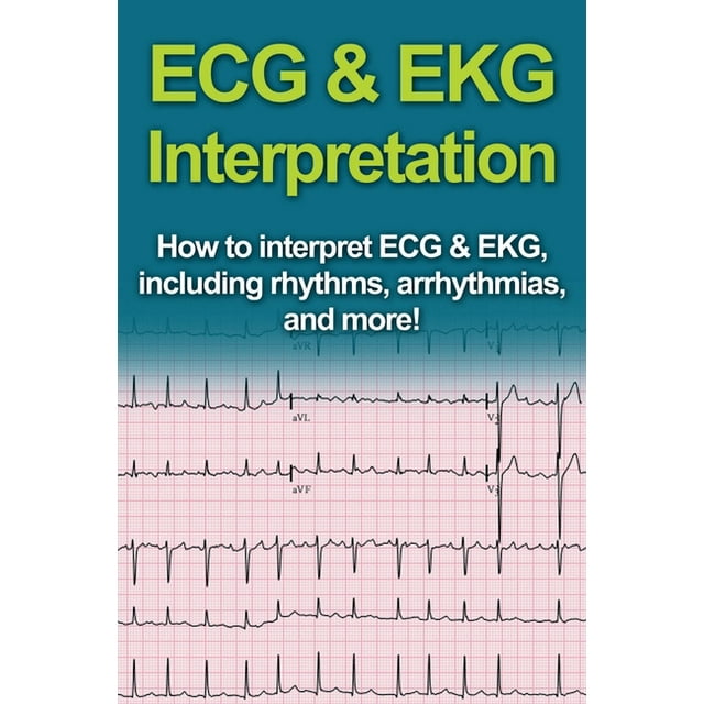 ECG & EKG Interpretation How to interpret ECG & EKG, including rhythms