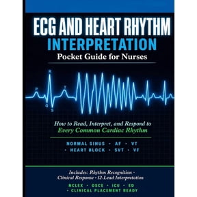 ECG and Heart Rhythm Interpretation Pocket Guide for Nurses: How to Read, Interpret, and Respond to Every Common Cardiac, (Paperback)