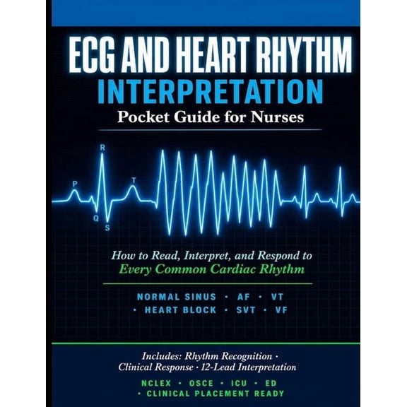 ECG and Heart Rhythm Interpretation Pocket Guide for Nurses: How to Read, Interpret, and Respond to Every Common Cardiac, (Paperback)