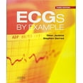 thumbnail image 1 of Pre-Owned ECGs by Example 9780702042287 Used, 1 of 1