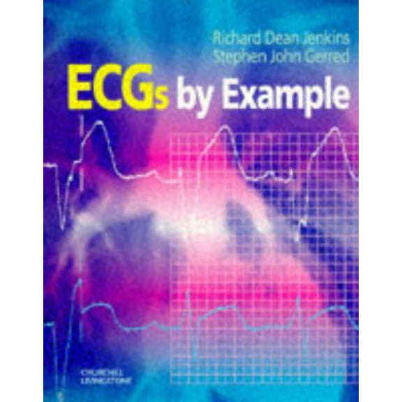 Pre-Owned ECGs by Example (Paperback) 0443056978 9780443056970