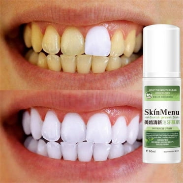 ECPECAD Natural Remove Stain Yellow Teeth White Tooth Cleaning Oral Mouth Spray 60ml