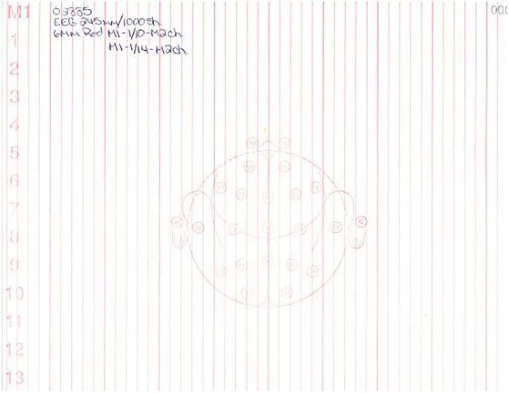 EEG Paper (245MM X 300MM X 1000 SHEETS) 10/14 Channel, Fv245-30k, Head on Every Page (Case of 2 Packs