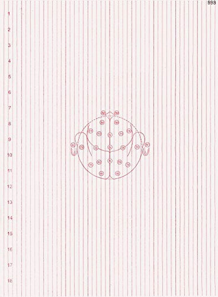 EEG Paper for Grass A818D (406MM X 300MM X 1000 Sheets 6MM RED) (2)
