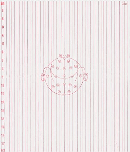 EEG Paper for Nicolet 1A97 (345MM X 300 MM X 1000 Sheets 6MM RED Channels) 220-703400 (2)