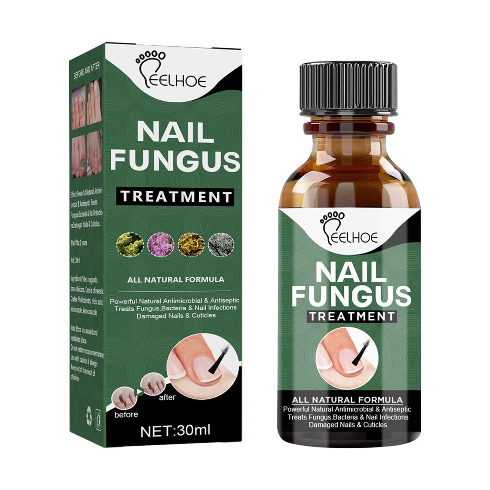 EELHOE 30ml Nail Fungus Solution Herbal Extracts Remove Onychomycosis
