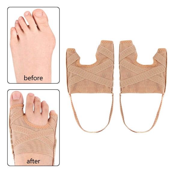 EHJRE 2 Pieces Toe Separator Soft Non Slip Alleviates Pain Toe Inversion Corrector S