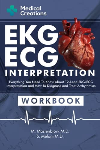 Pre-Owned EKG/ECG Interpretation: Everything you Need to Know about the ...