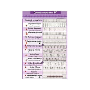 EKG ECG Rhythms Metal Sign Arrhythmia Recognition Chart Medical Reference Tool for Nurses Healthcare Professionals Students 12x8 Inch